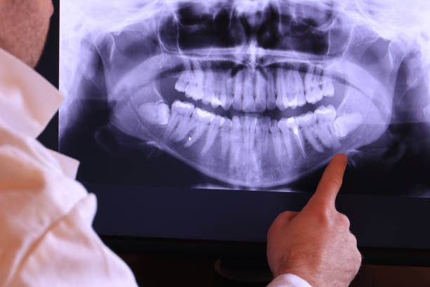 Best Emergency Wisdom Teeth Removal in Morrilton, AR