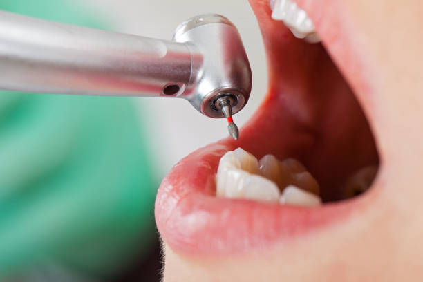 Best Emergency Root Canal Treatment in Morrilton, AR